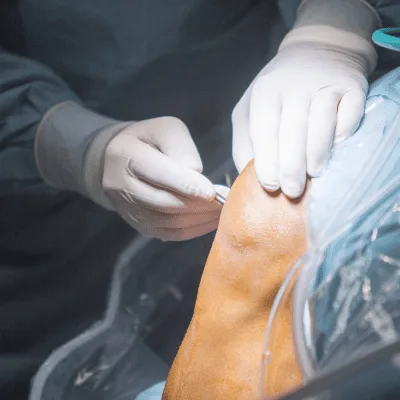 Diagnóstico y tratamiento clínico para problemas de rodilla infantil en el Estado de México